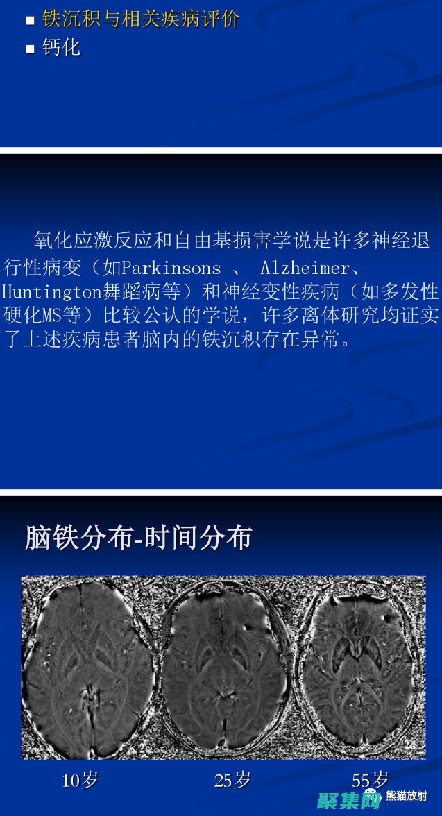避免 Switch Case 語(yǔ)句中的常見錯(cuò)誤：清除陷阱 (避免的意思)