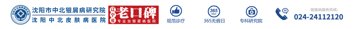 「沈陽中北牛皮癬醫院」-沈陽牛皮癬專科醫院-沈陽銀屑病醫院哪個正規-沈陽看效果好的銀屑病